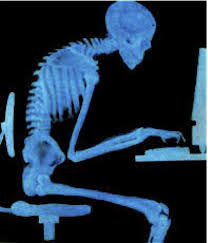 X-Ray of person hunched in front of computer. it's because i'm getting old.